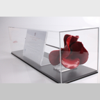 Primo Landscape poppy display case with black base - side detail view